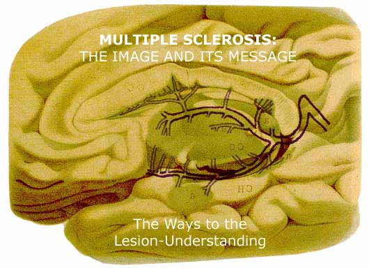 Mutiple Sclerosis - The Image and its message